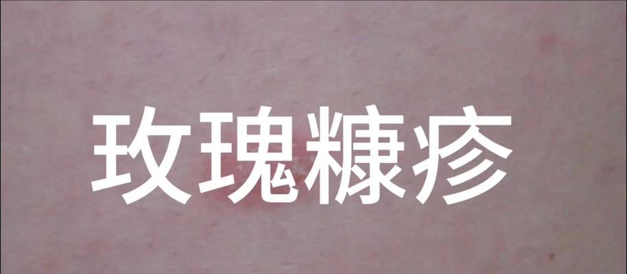 玫瑰为何会出现单花瓣无花蕊的情况？这种现象的原因是什么？