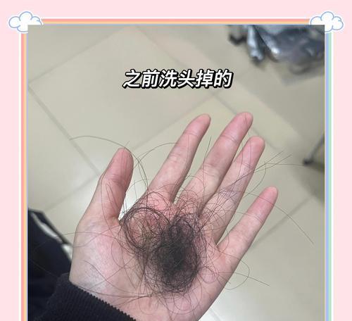 侧柏树叶子发黄的恢复方法是什么？